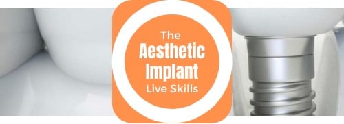 The Aesthetic Implant Live Skills The Campbell Academy Nottingham