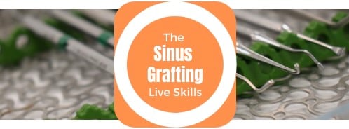 The Sinus Grafting Live Skills The Campbell Academy Nottingham