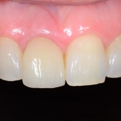 case 2