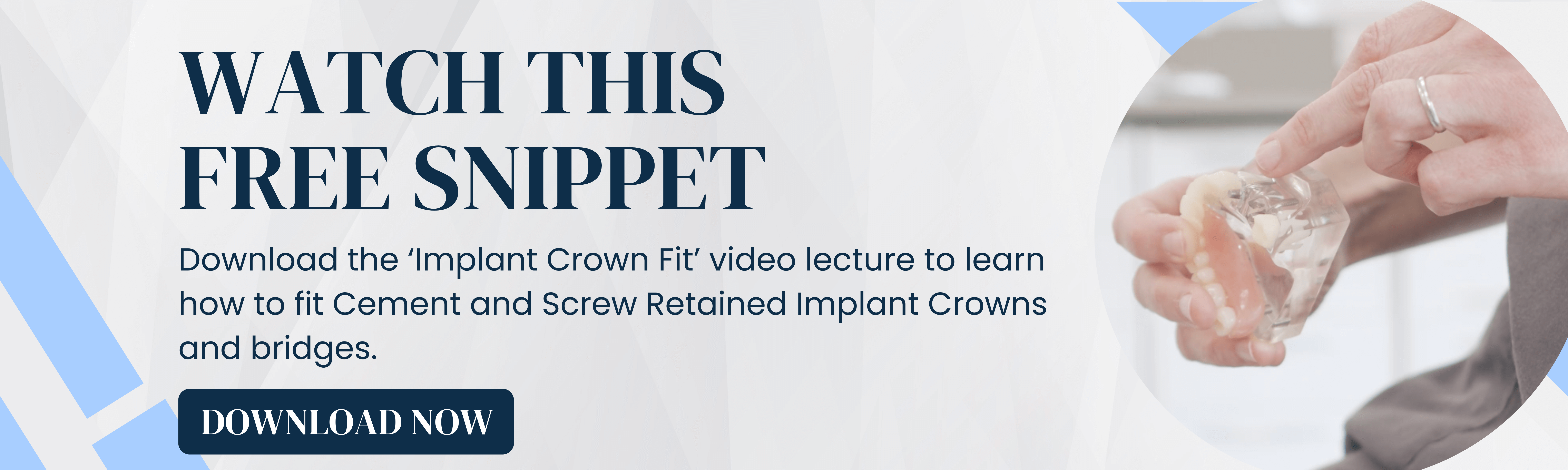 Download the Implant Crown Fit video lecture