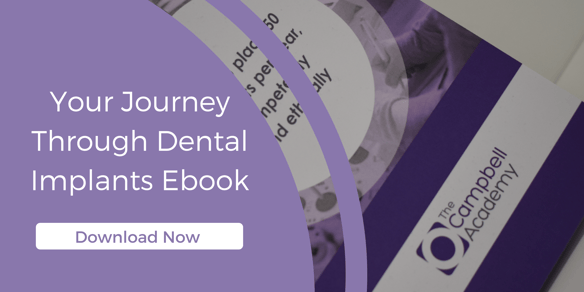 Your journey through dental implants -3