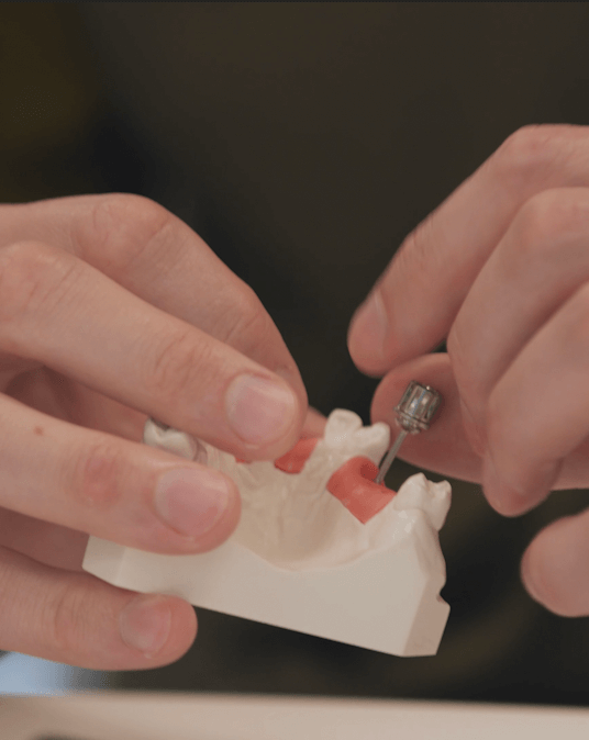 Online Implant Restorative Course
